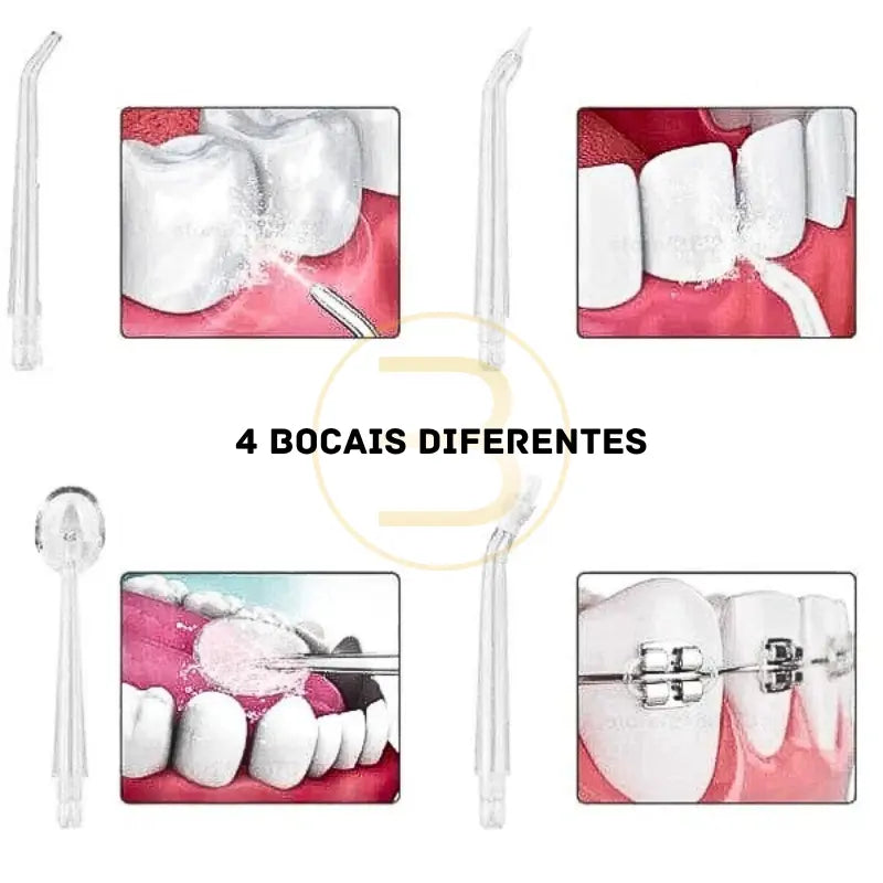 Irrigador Bucal Limpeza Completa DentalClean® + BRINDE SÓ HOJE!